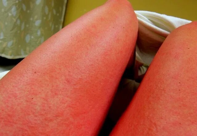 Источник https://avatars.mds.yandex.net/i?id=4545a36ad1d13d5c439ac12f3e9a8b67_l-5265887-images-thumbs&n=13