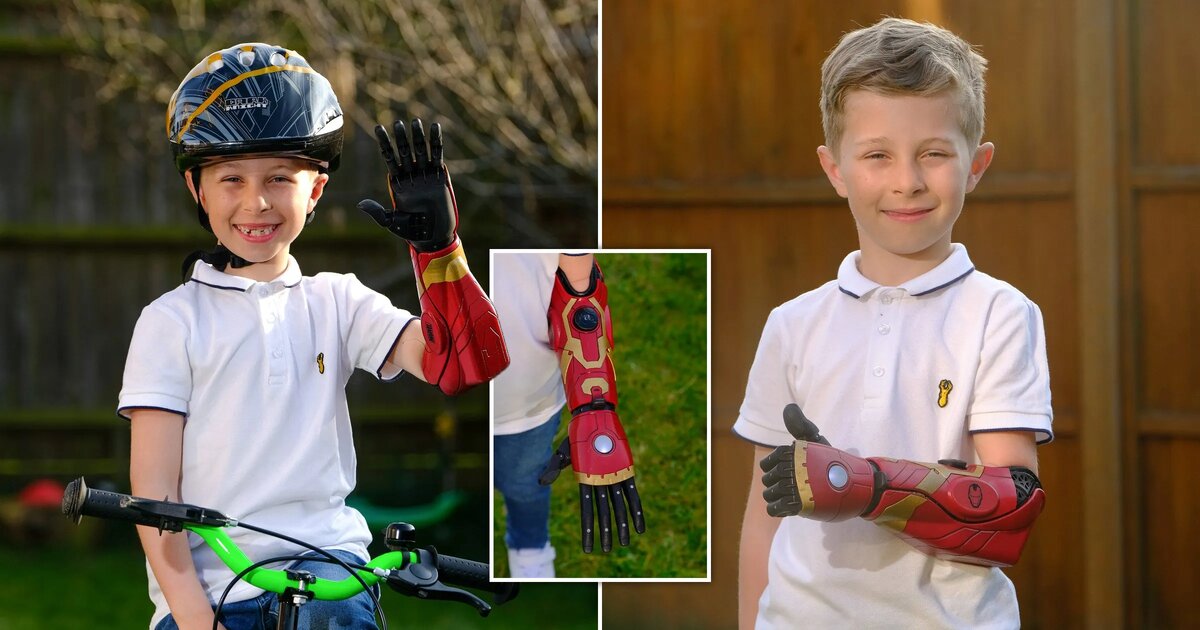 Мальчик с бионическим протезом Hero Arm от Open Bionics