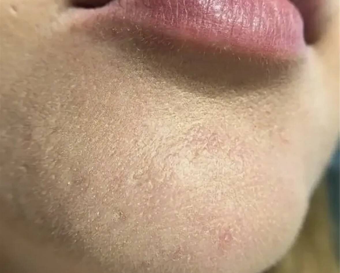 Тон бывает предателем 