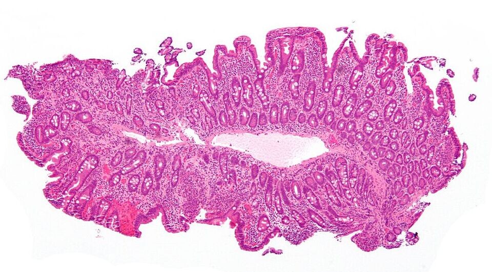   Nephron / Wikimedia Commons, CC-BY-SA-3.0