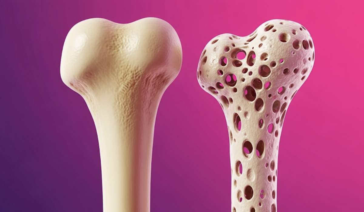 Признаки ослабления костей после 60