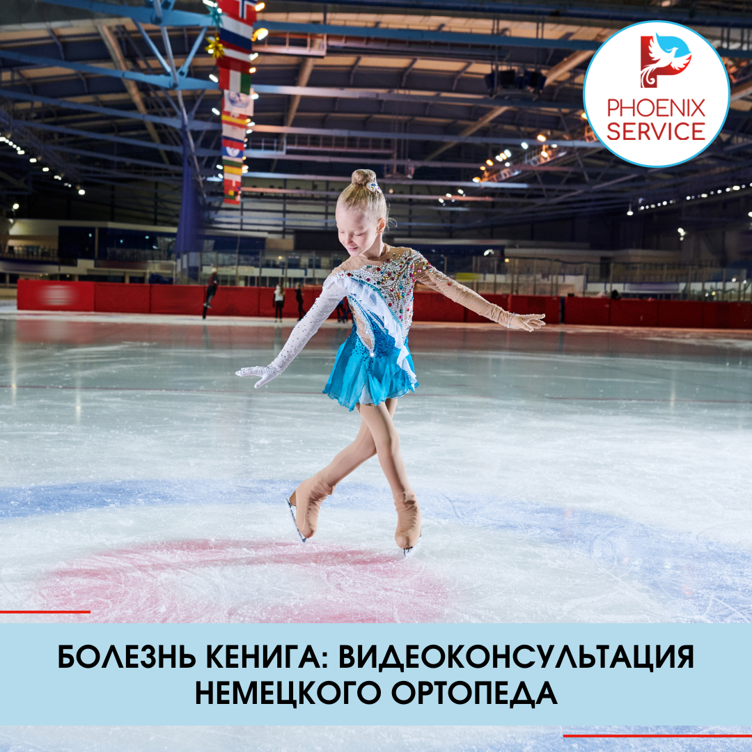 Болезнь Кенига: видеоконсультация немецкого ортопеда