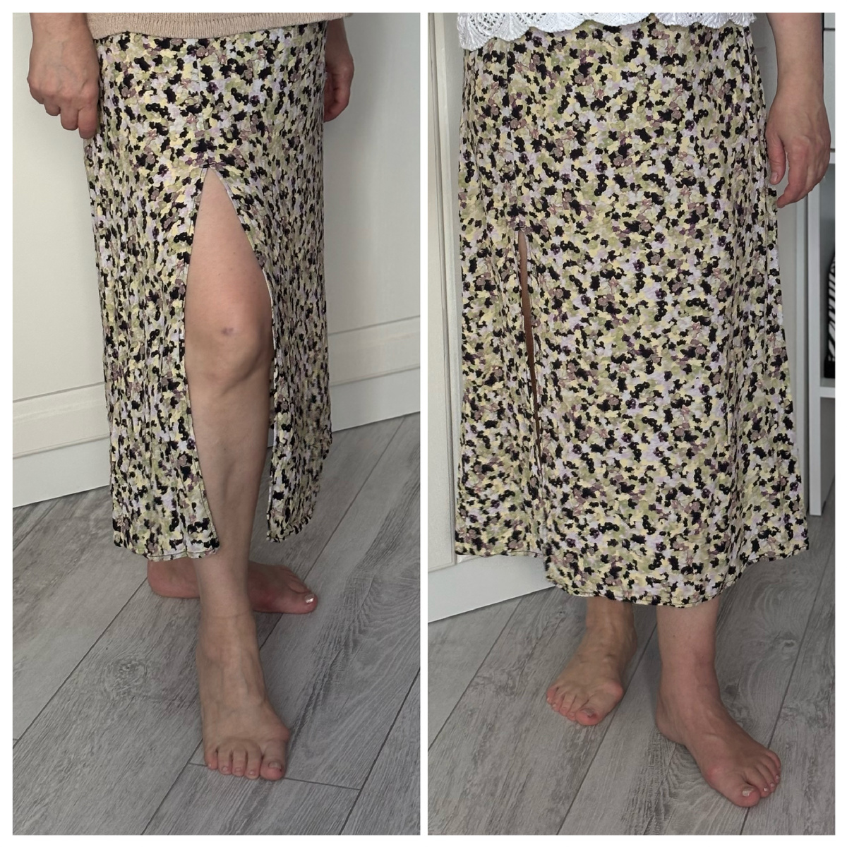 Синяк не отфотошопила. Маму мы не бьем. Это она сама.