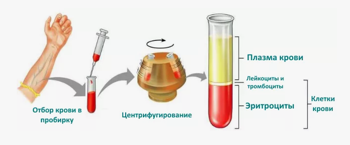 Взято отсюда: https://orthospine.ru/upload/medialibrary/b07/mybyeq49p8h1jyiflwx9zjqgdn8ibku7.png