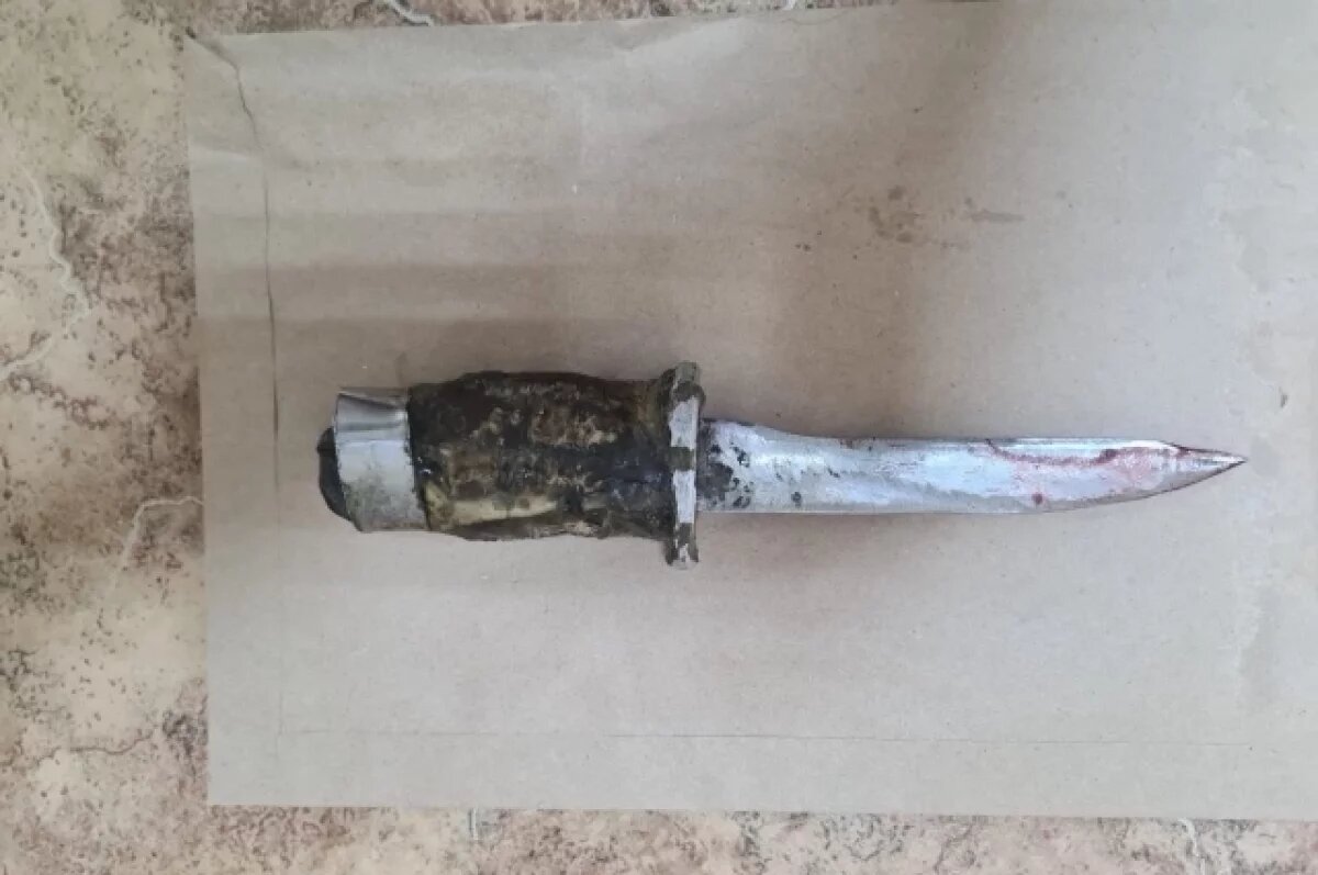    Жительница Новосибирска простила сожителя, пытавшегося ее убить