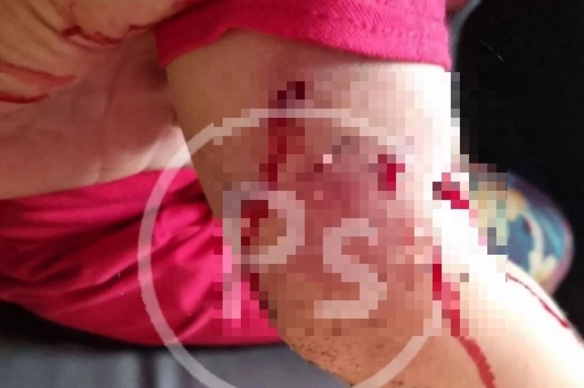    Хозяин собаки ответит за нападение животного на 5-летнюю девочку в Приморье