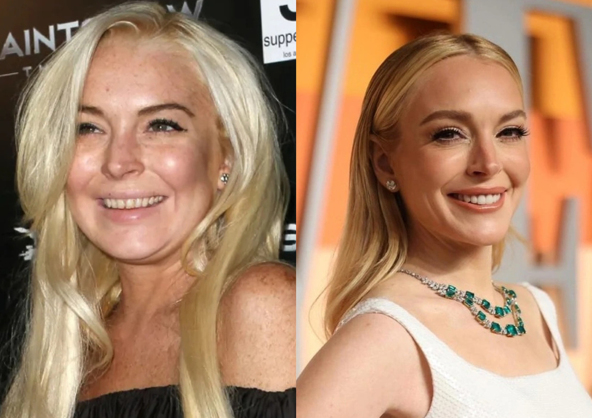 Линдси Лохан до и после