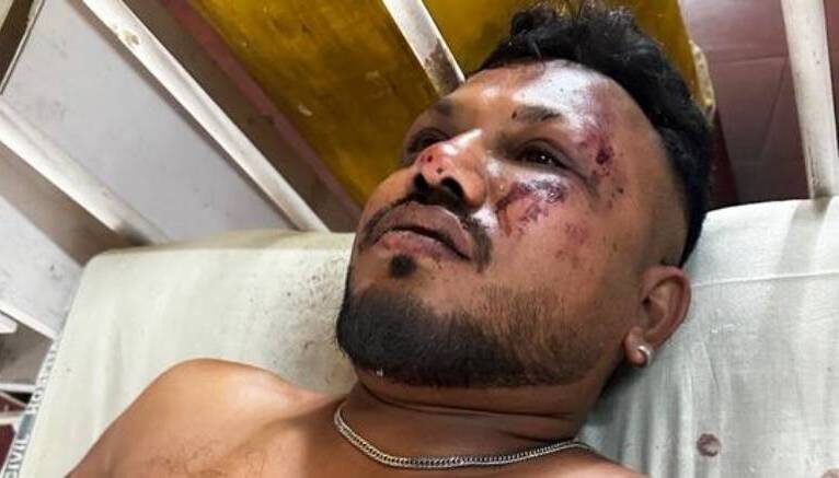    Рамеш Вишвашкумар выжил в авиакатастрофеКадр из видео