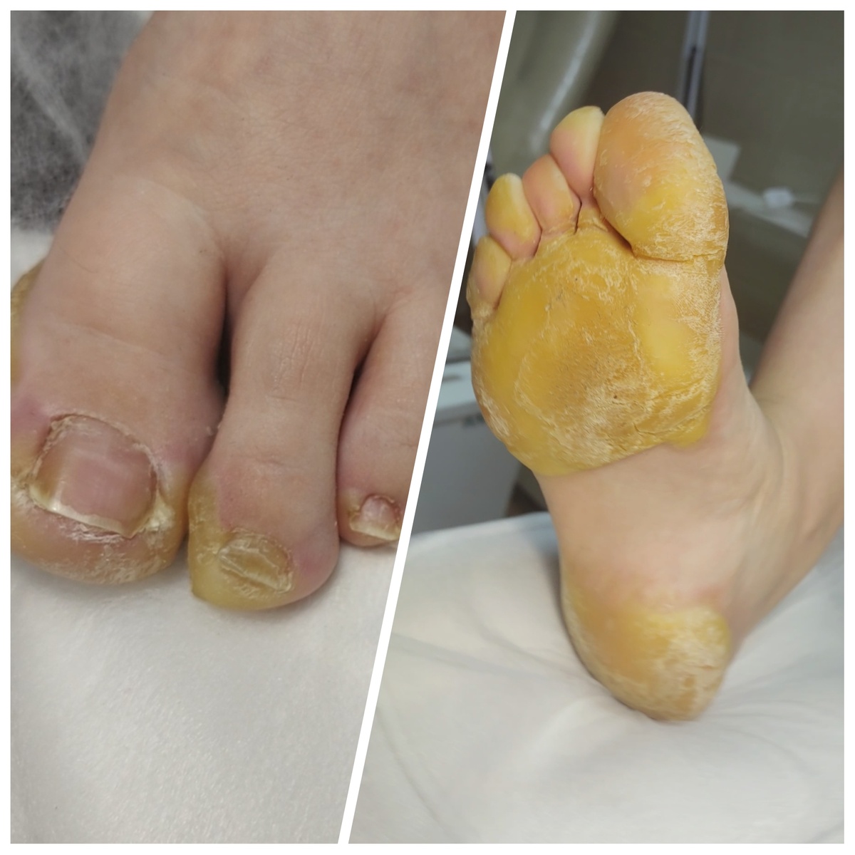 До, после не снимала