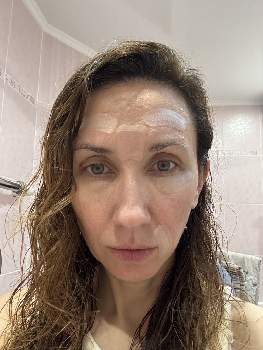 Фото 1 с патчами