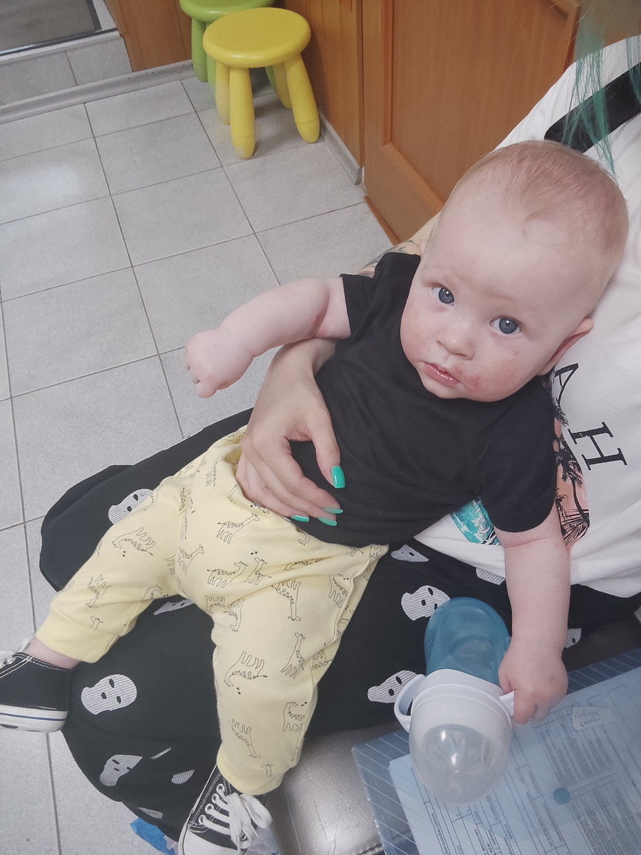 Фото автора, 6,5 мес, приём у аллерголога