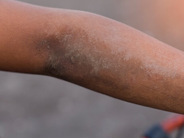    Фото: 123RF/kayasit