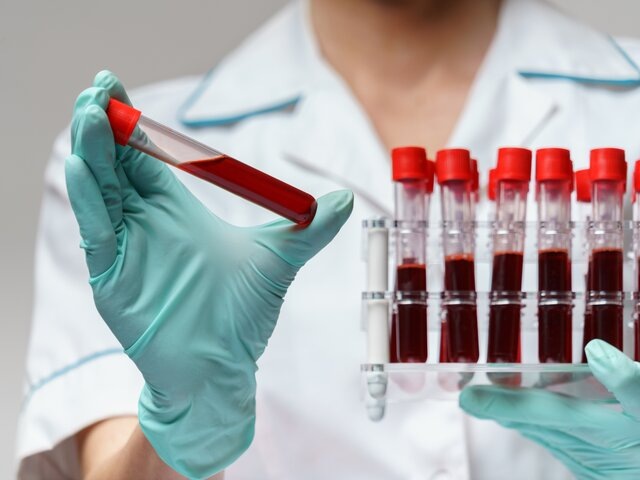    Фото: 123RF/repinanatoly