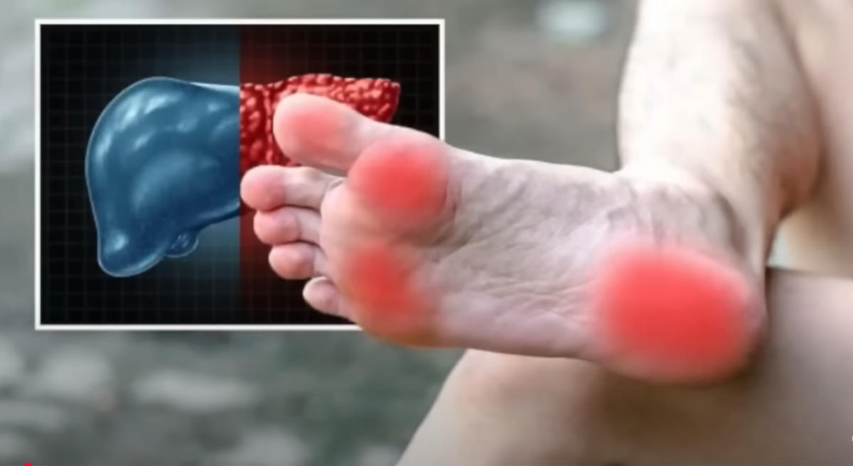 Как стопы «скажут» о здоровье печени