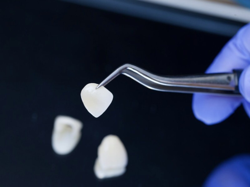    Биоинженерный зубной имплант может расти и чувствовать