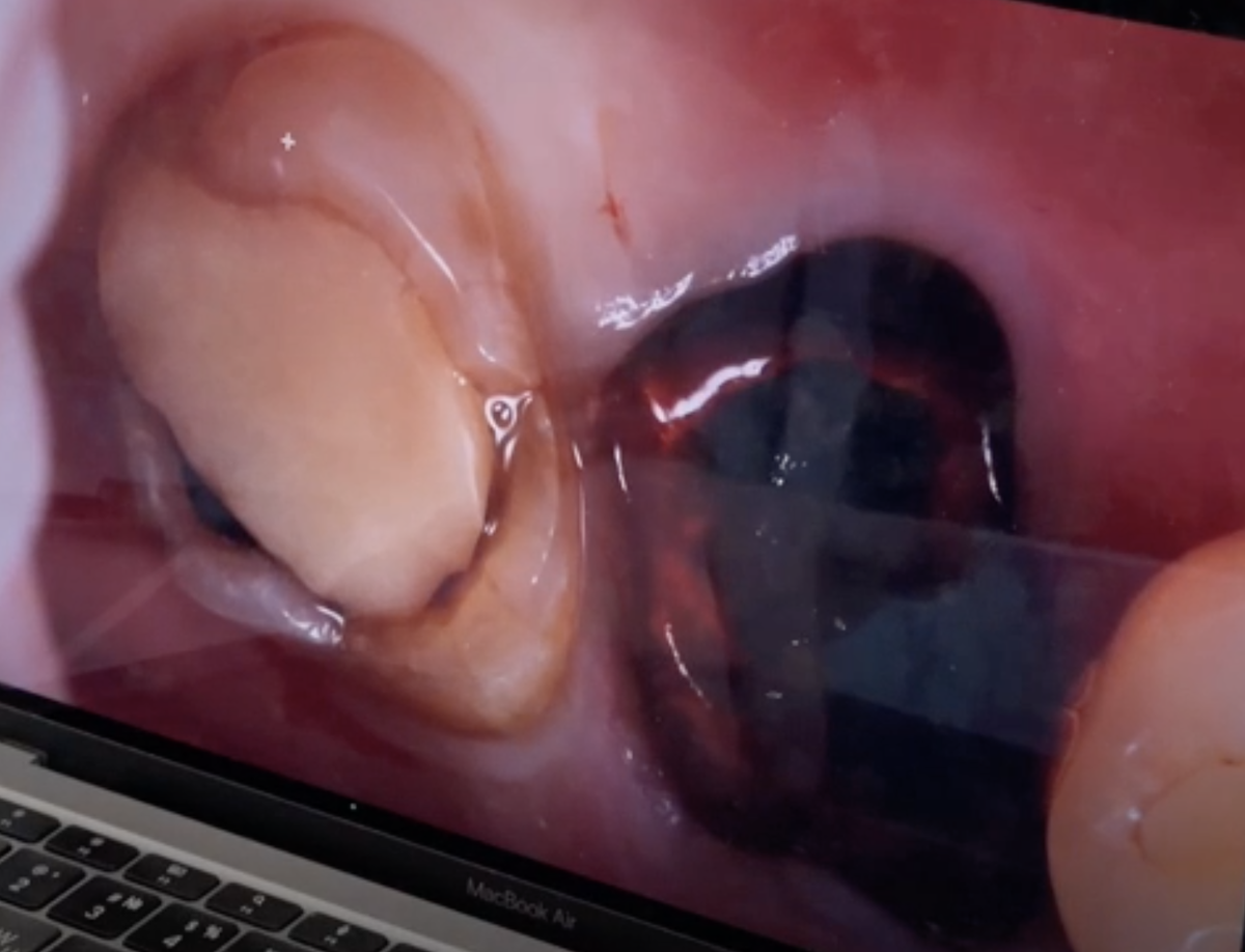 Проблемный зуб