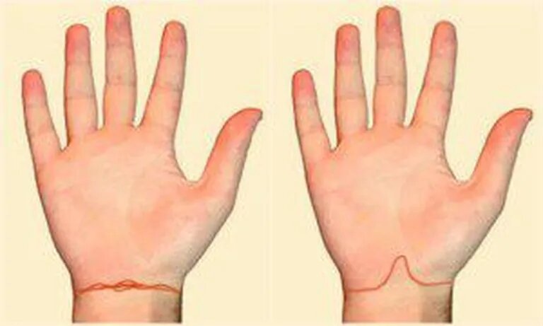 Волнистая линия, прерывистая линия - говорят о сложностях со здоровьем. Хронических заболеваниях