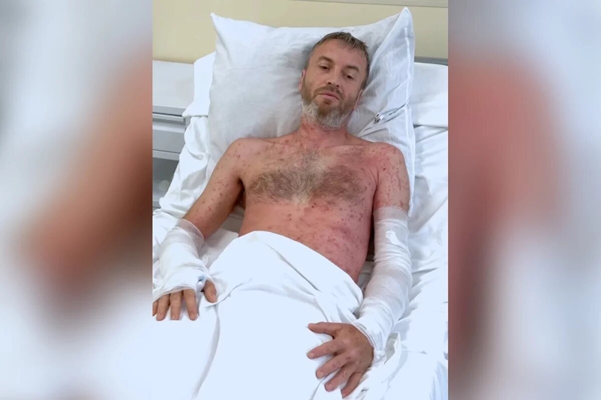    Медицинские специалисты настоятельно предупреждают: летний сезон только начинается, и при попадании сока борщевика на кожу необходимо немедленно обращаться за медицинской помощью.