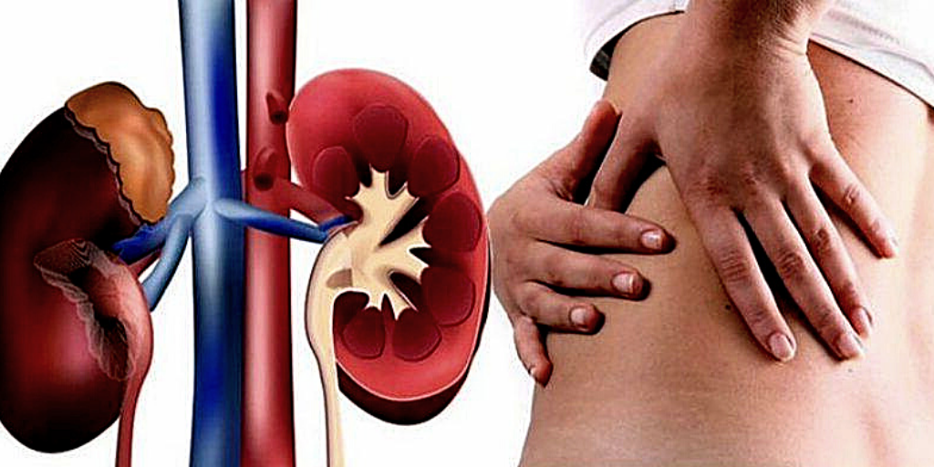 Самый первый признак больных почек