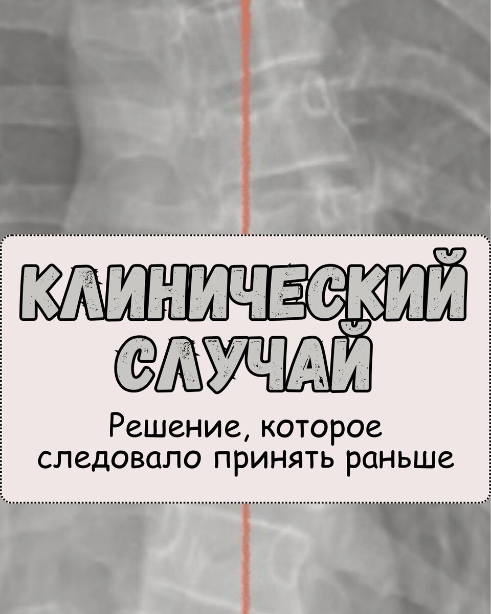 Случай из практики. Решение, которое следовало принять раньше