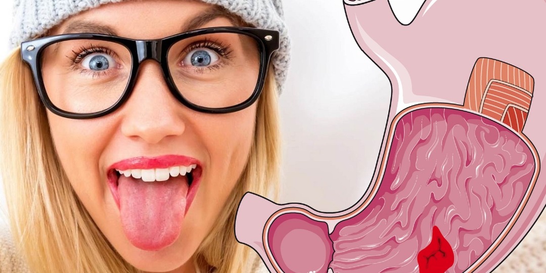 Что говорит цвет языка о здоровье печени и ЖКТ