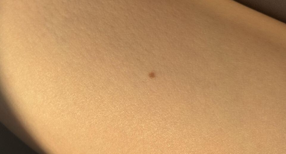    Пресс-секретарь ГБУЗ Московской области «МОККВД»