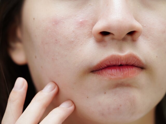    Фото: 123RF/sweettomato