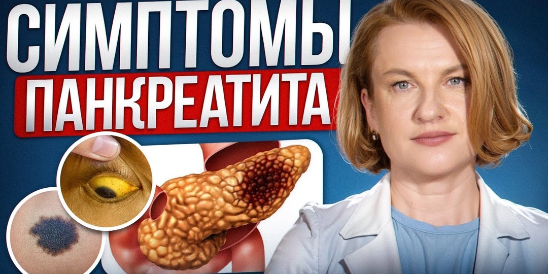 Три ранних признака Панкреатита, которые легко перепутать с несварением