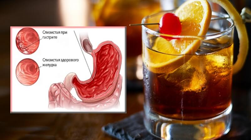 Влияние алкоголя на желудок