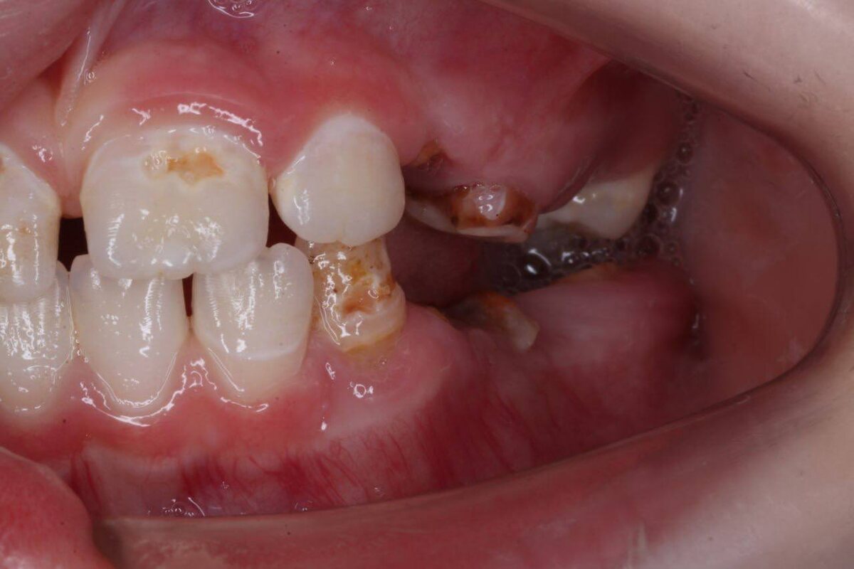 листайте галерею вправо