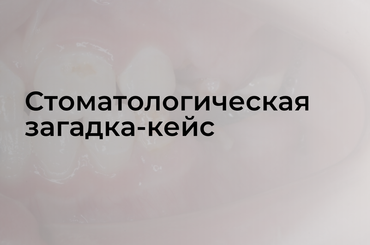 Листайте вправо