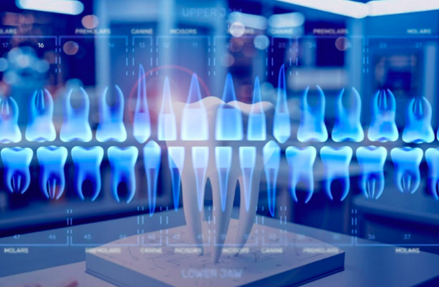 Рентген зубов. Источник: https://www.miloserdie.ru 