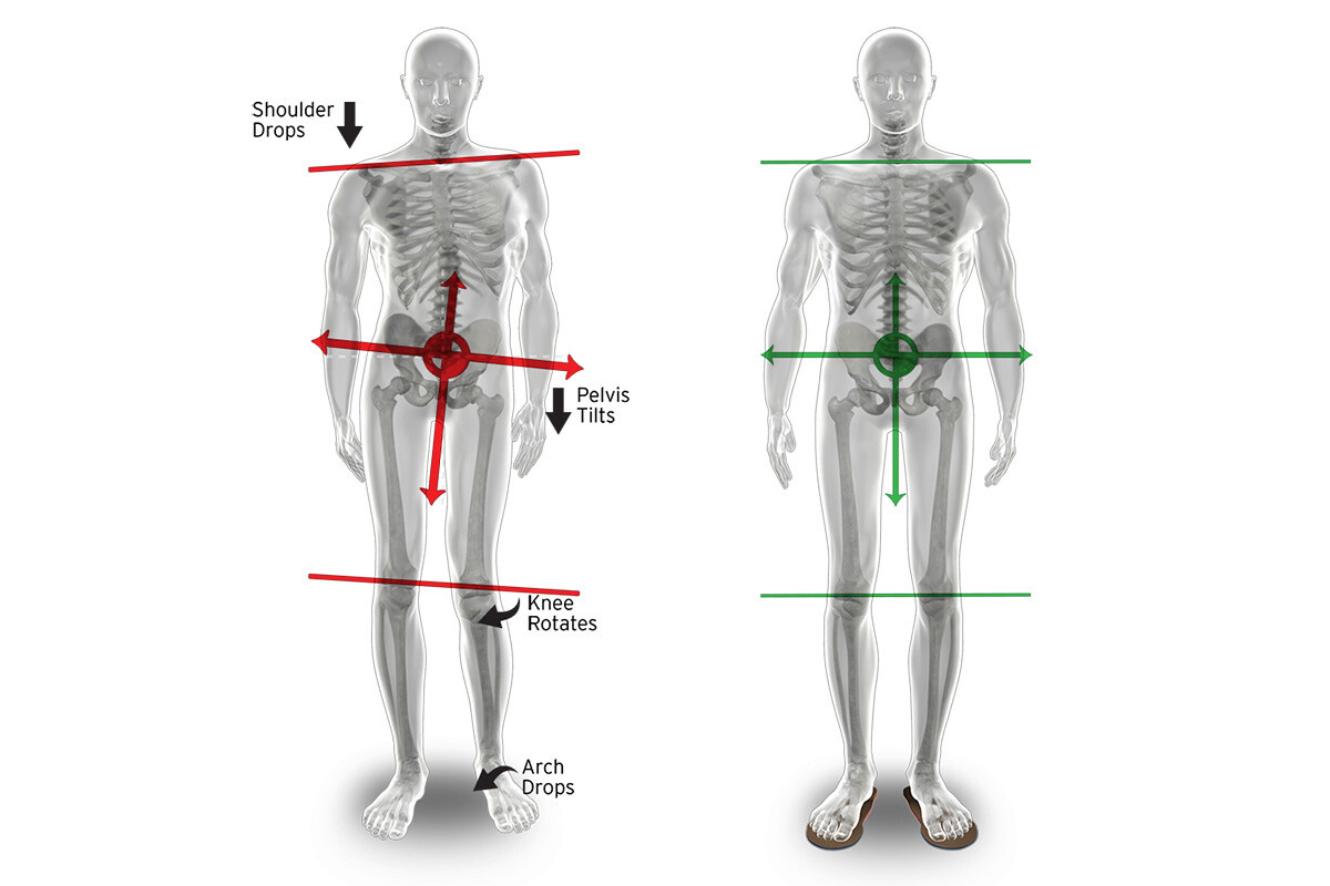 Изменения в теле из-за положения таза