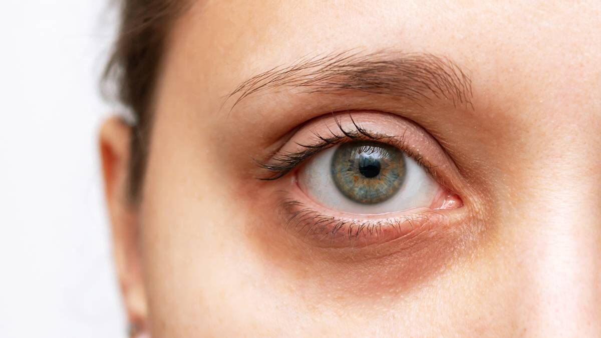    Фото: Shutterstock