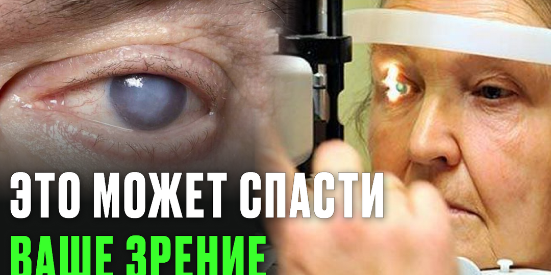Катаракта после 50 — неизбежна? О чём молчат врачи и как реально сохранить зрение