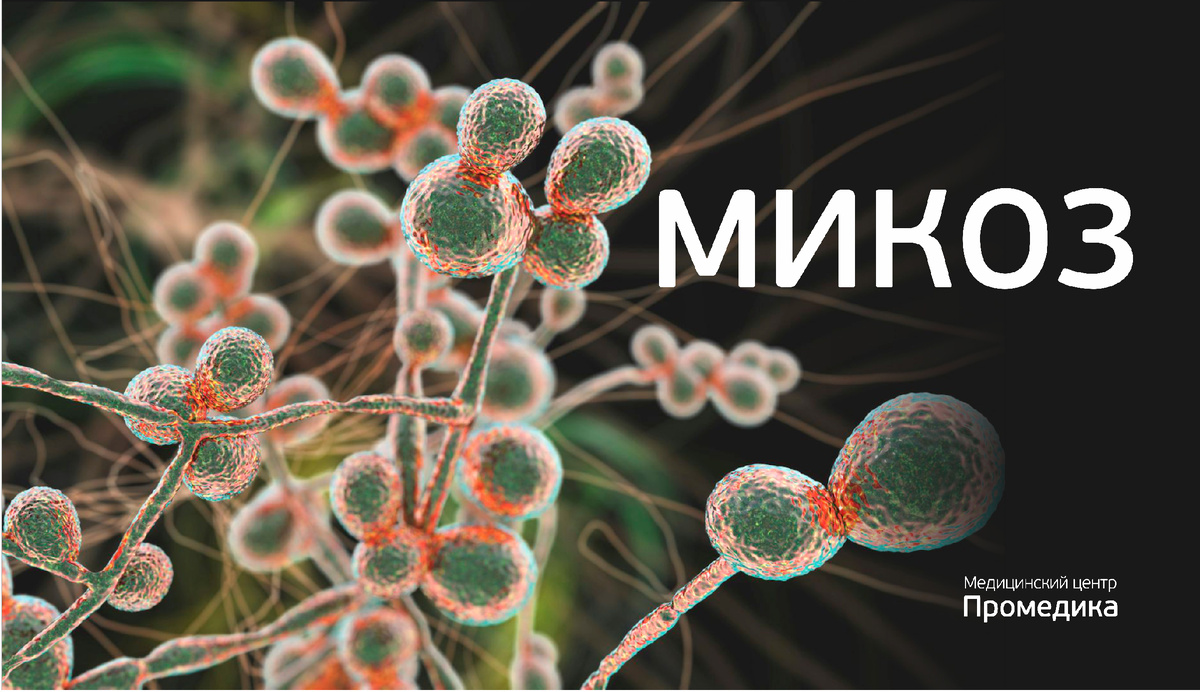 Микоз стоп (грибок стопы): симптомы, лечение и профилактика