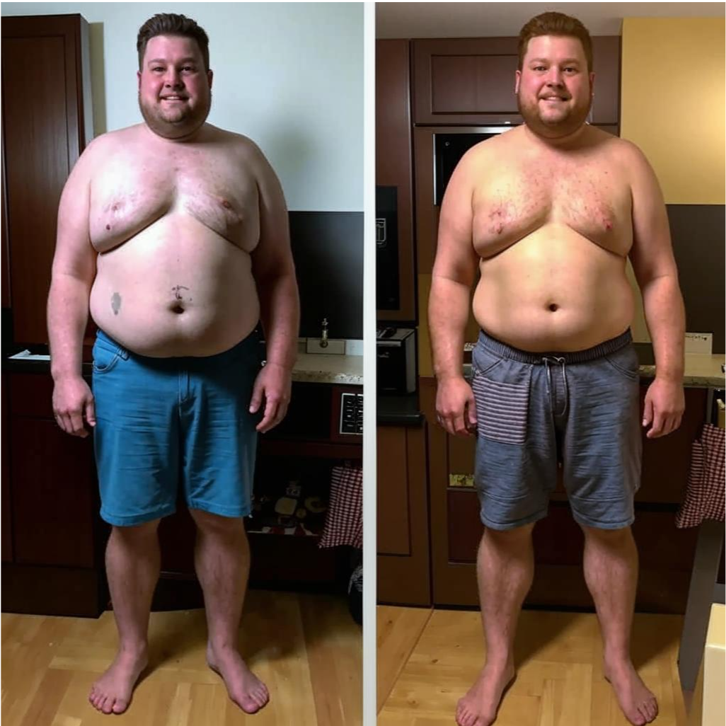 Мой эксперимент начался с шокирующего фото в бассейне — 112 кг на весах и одышка при подъеме на 2 этаж. Через 120 дней я весил 82 кг. И самое удивительное — я не сидел на диетах. Вот мой пошаговый метод.
1. Подготовка: что я изменил до старта
📌 Замерил базовые показатели:

Обхват талии: 118 см → 86 см

Давление: 145/90 → 120/75

Фото "до" в нижнем белье (важно для мотивации)

📌 Купил только 3 вещи:

Кухонные весы (300 руб.)

Фитнес-браслет (отслеживание сна)

Дневник питания (обычная тетрадь)

2. Мое расписание на день
⏰ 7:00 — Вода + движение

2 стакана воды комнатной температуры

15 минут йоги (комплекс "Приветствие солнцу")

🍳 8:00 — Завтрак-бомба

Вариант 1: Омлет с сыром + авокадо

Вариант 2: Творог 5% + орехи + мед

🏃 12:30 — "Офисный" фитнес

3 подхода по 20 приседаний (в туалетной комнате)

Ходьба по лестнице вместо лифта

🍗 18:00 — Ужин без угрызений совести

Говядина/курица + гречка/бурый рис

Салат с оливковым маслом

📊 22:00 — Анализ дня

Взвешивание (только 1 раз в день!)

Запись в дневник: "Что съел → Как себя чувствую"

3. 5 неочевидных правил
"Правило ладони" — белок размером с ладонь, гарнир — с кулак

"20 минут" — после еды обязательно двигаться

"Сырный день" — раз в неделю ем любые сыры без ограничений

"Без мук выбора" — 5 проверенных завтраков и ужинов по кругу

"Сон важнее спортзала" — ложусь строго до 23:00

💡 Важно: Я не считал калории и не голодал. Секрет — в регулярности и простых ритуалах. Первые 5 кг ушли за 2 недели только за счет воды и отказа от сахара в чае.

👉 Хотите мой полный чек-лист? Пишите "Хочу" в комментариях — вышлю PDF!