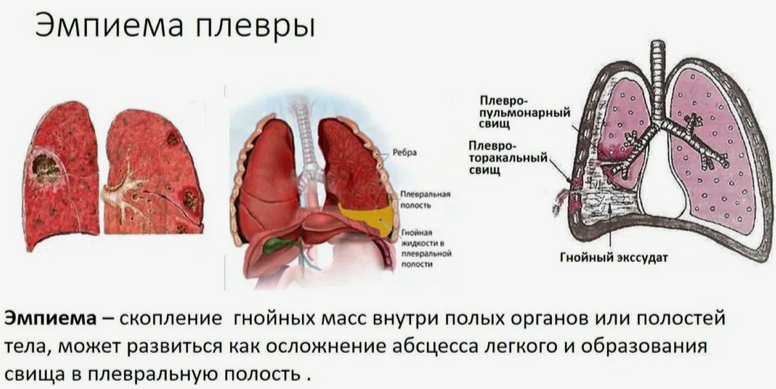 Проще показать что это, чем объяснить.