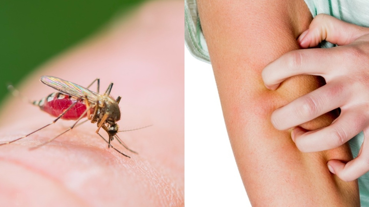 Так выглядели мои руки после часа работы в огороде без защиты от комаров