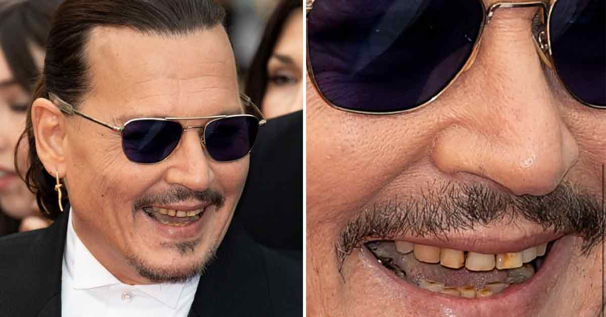 5 привычек, которые плохо сказываются на зубах 