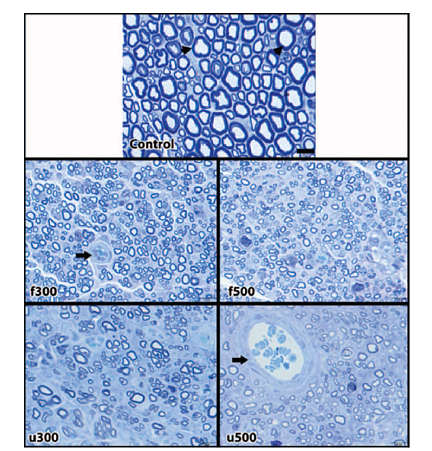 Внешний вид образцов нервов соответствующих
групп под световым микроскопом. Относительно лучшая регенерация была отмечена в группах f300 с точки зрения
миелинизированных аксонов, которые можно увидеть под световым микроскопом.