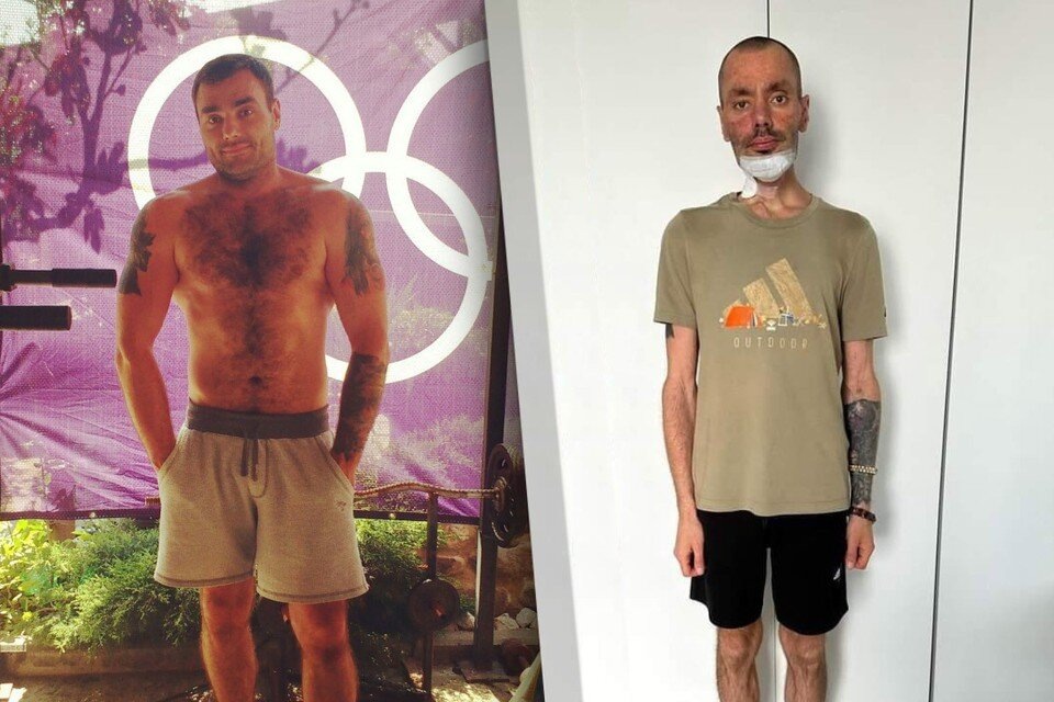 Вес Александра упал с 96 до 57 кг