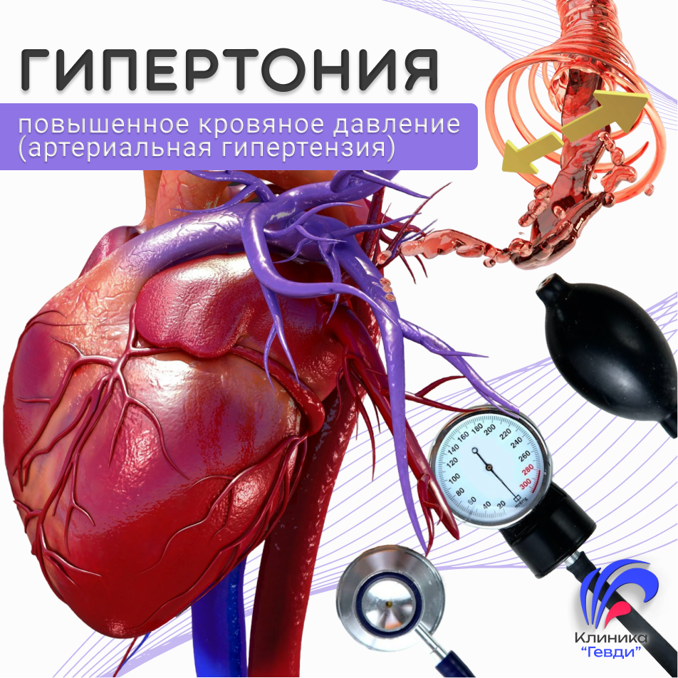 Гипертония. Высокое кровяное давление. Артериальная гипертензия