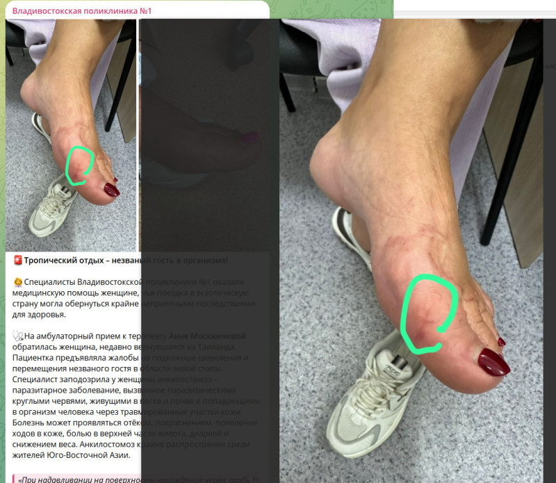    СКРИНШОТ ТГ-КАНАЛА T.ME/VLDPOL1