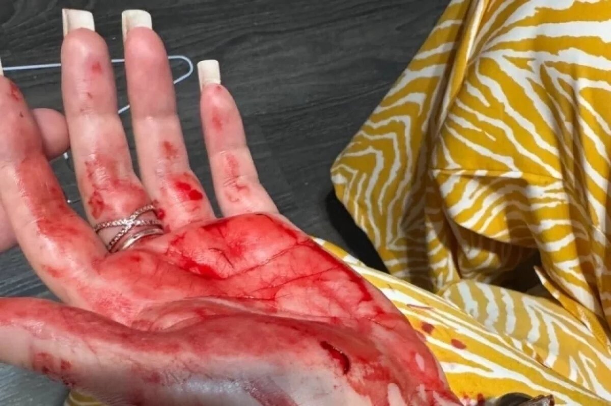    Полиция задержала жителя Владивостока по делу о жестоком избиении женщины