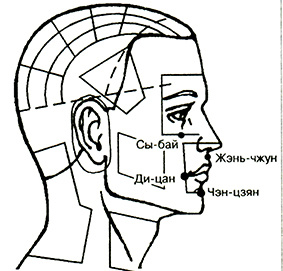 Схема биоточек “Паралич лицевого нерва", Рисунок из архива журнала «ФиС»