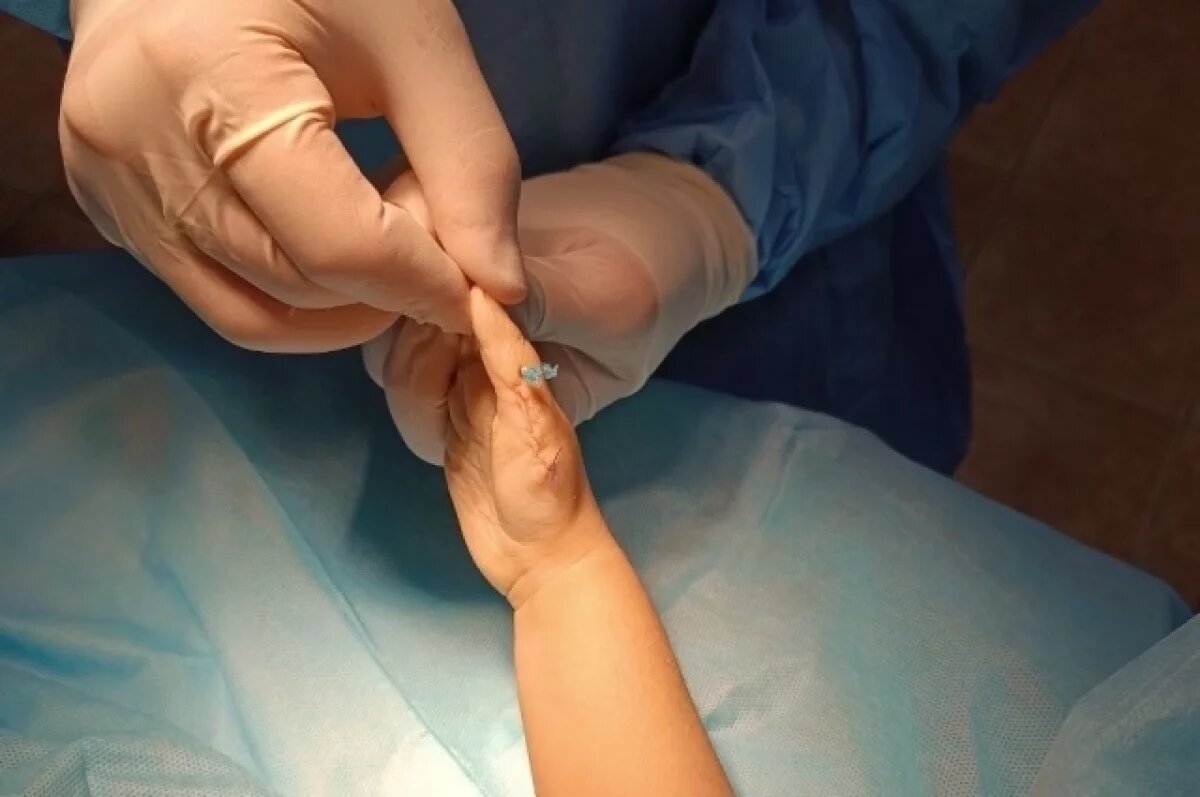    Тюменские хирурги помогли ребенку с редкой патологией пальцев