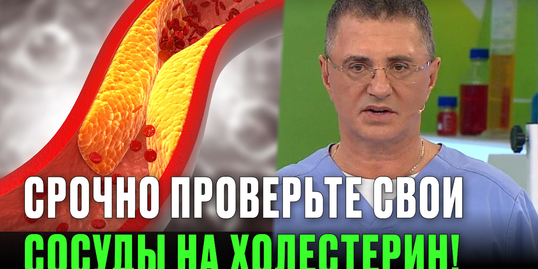 Холестерин зашкаливает, а вы не знаете? 7 простых способов проверить сосуды дома — до инфаркта!
