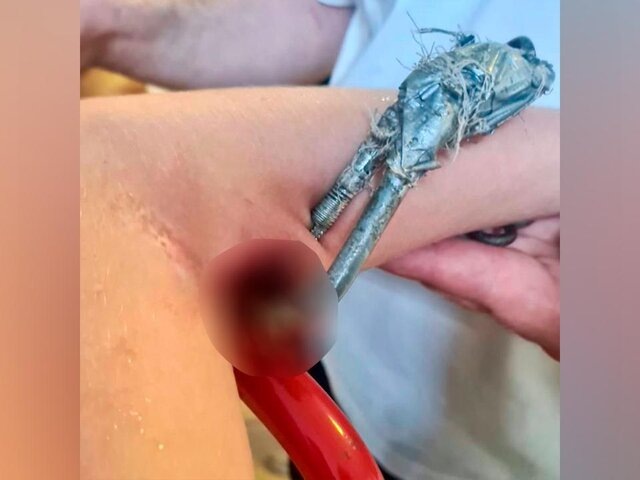    Фото: телеграм-канал "ГБУЗ МО "МОЦОМД"