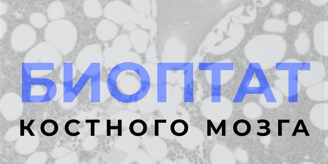 🔬 ИССЛЕДОВАНИЕ БИОПТАТА КОСТНОГО МОЗГА (ТРЕПАНОБИОПТАТА